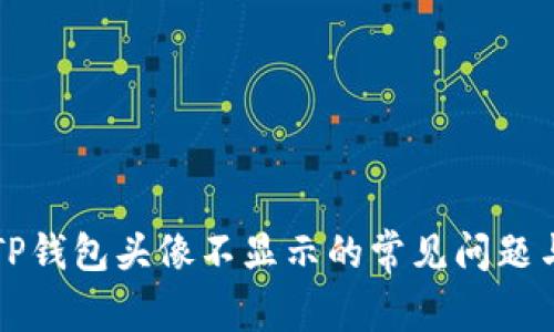 解决TP钱包头像不显示的常见问题与技巧